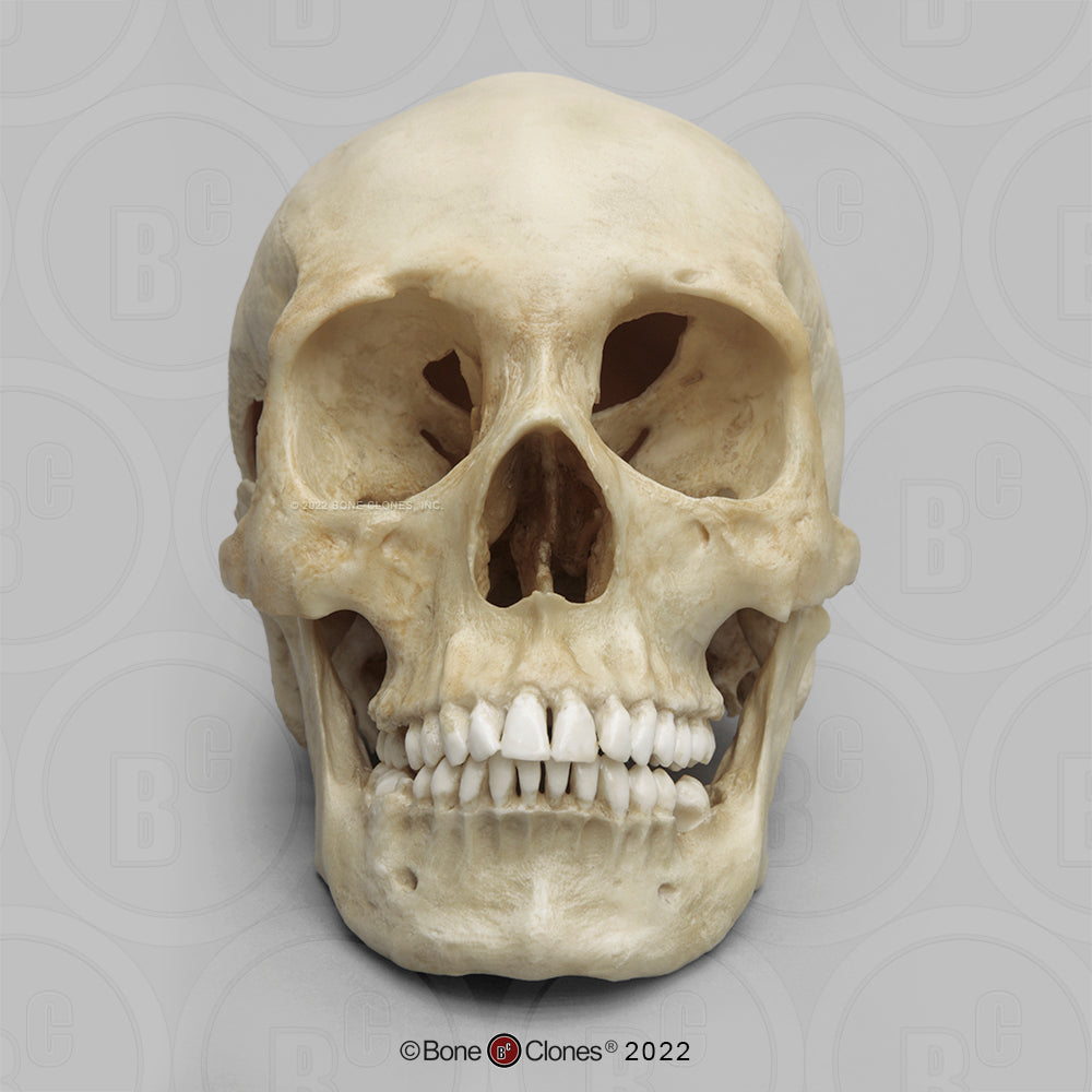 Bone Clones Forensic Trauma Skulls