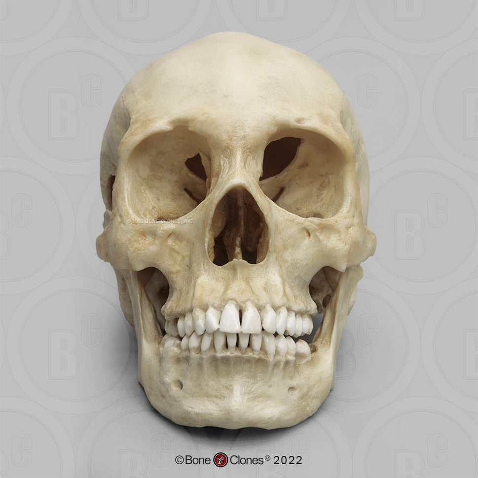 Bone Clones Forensic Trauma Skulls