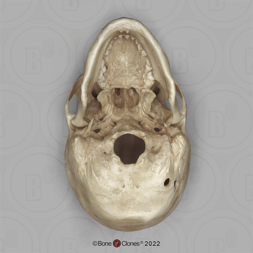 Bone Clones Forensic Trauma Skulls