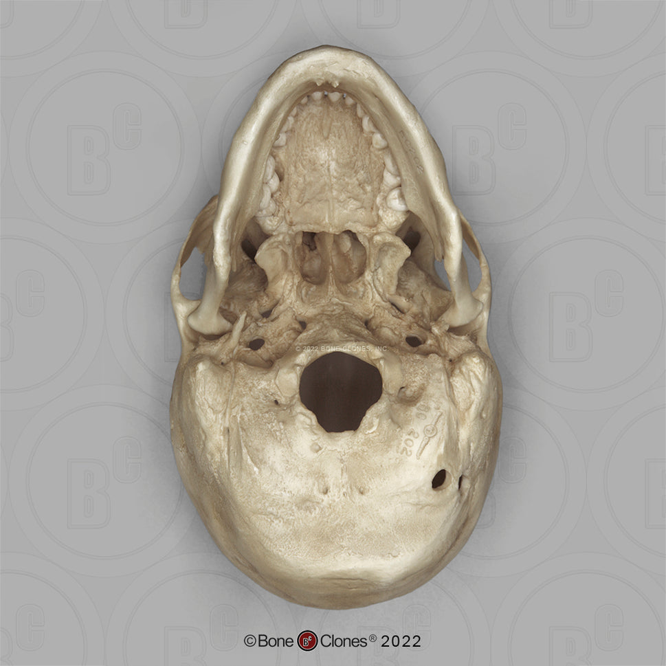 Bone Clones Forensic Trauma Skulls