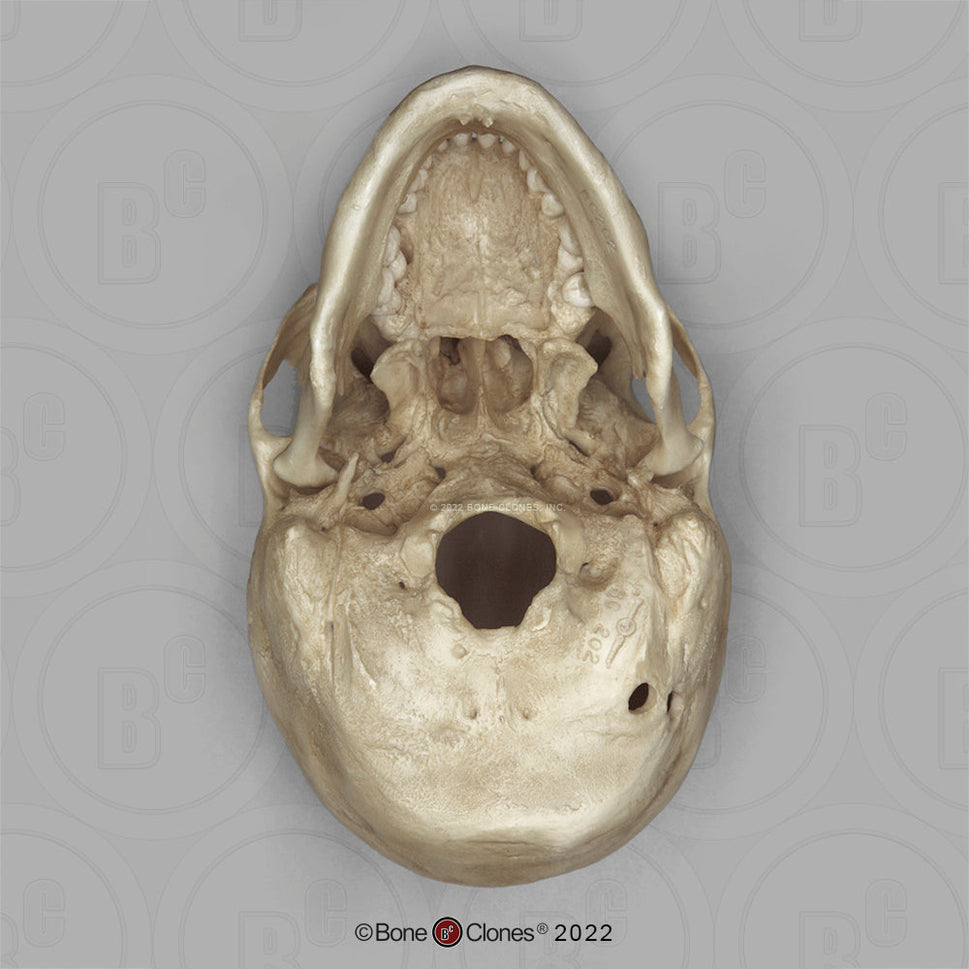 Bone Clones Forensic Trauma Skulls
