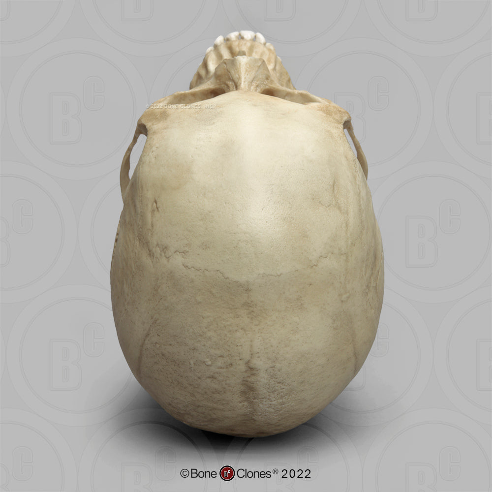 Bone Clones Forensic Trauma Skulls