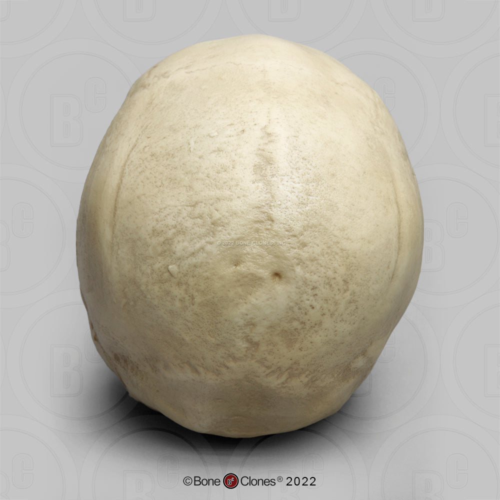 Bone Clones Forensic Trauma Skulls