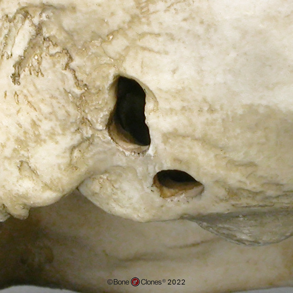 Bone Clones Forensic Trauma Skulls