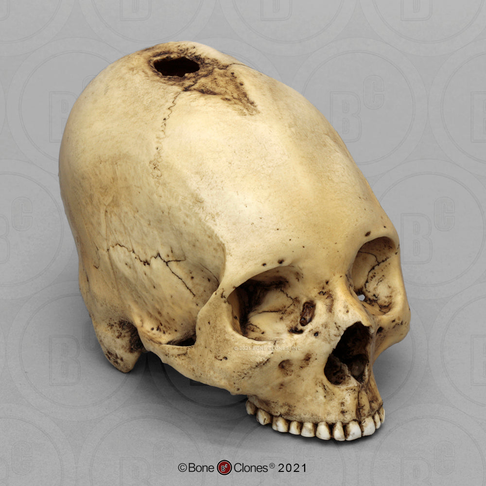 Bone Clones Forensic Trauma Skulls