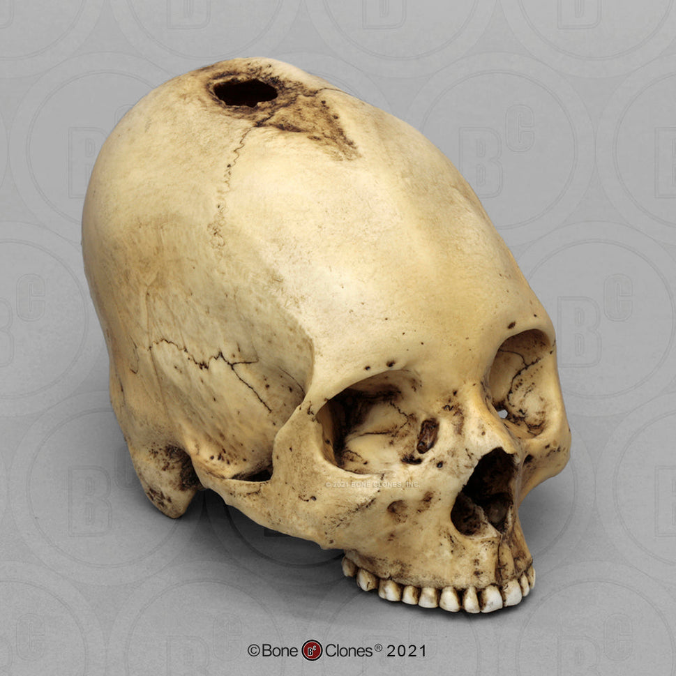 Bone Clones Forensic Trauma Skulls