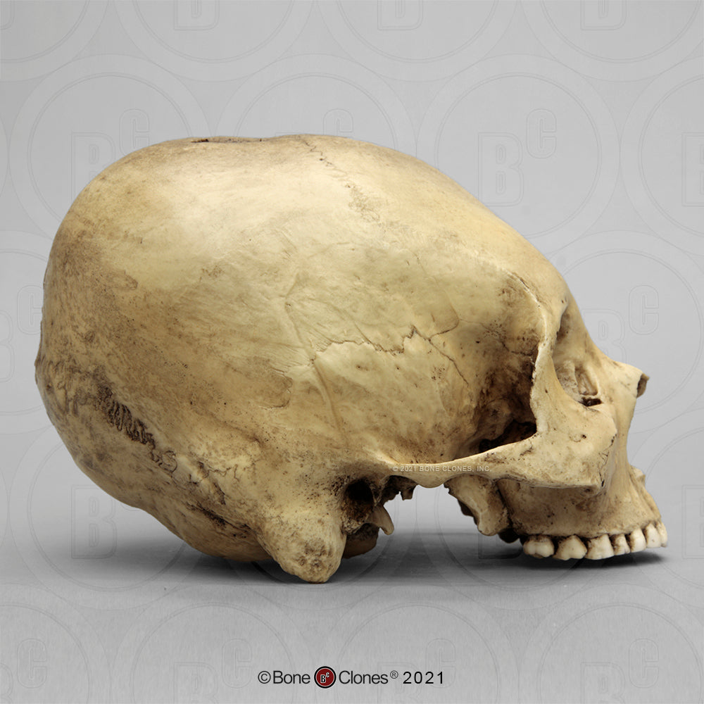 Bone Clones Forensic Trauma Skulls