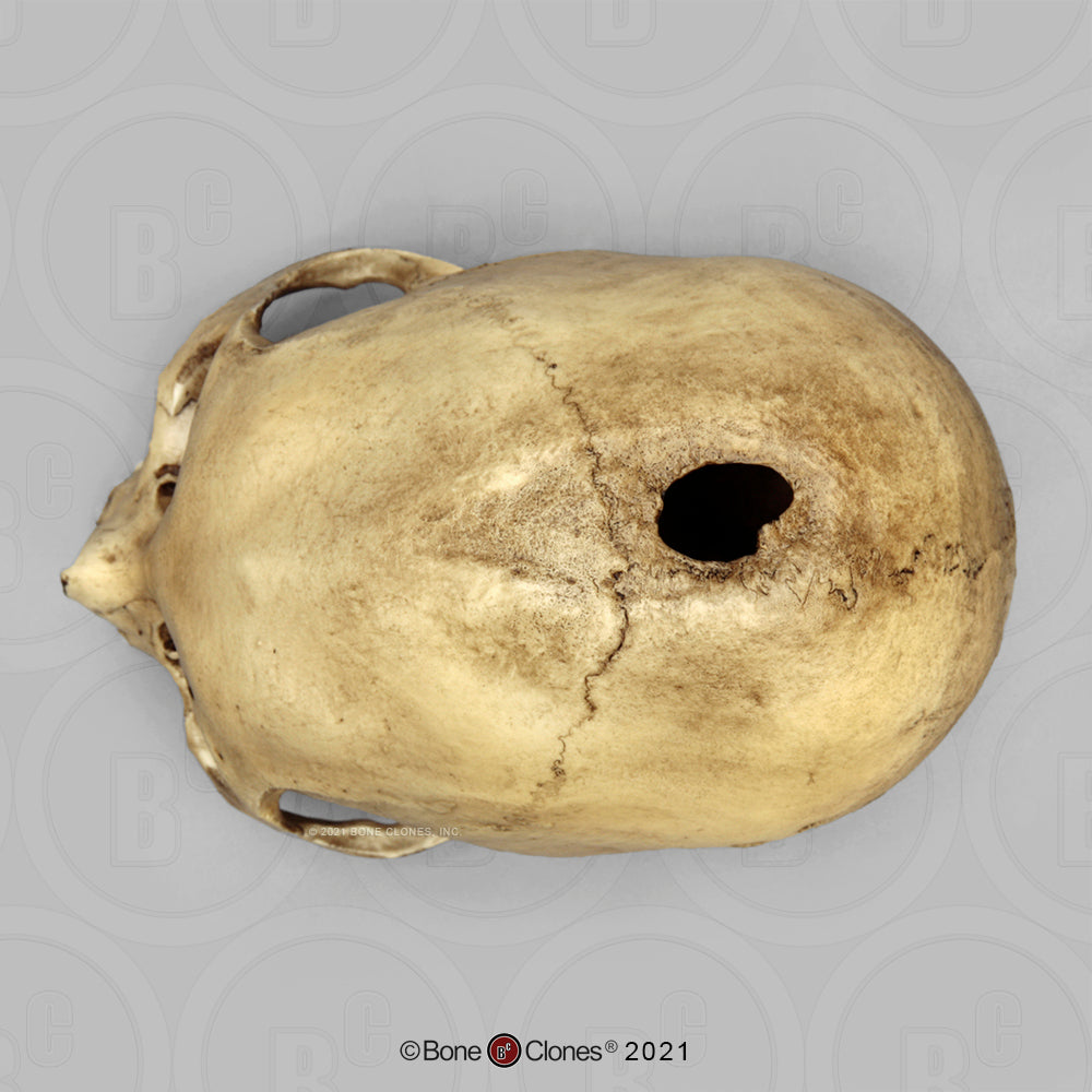 Bone Clones Forensic Trauma Skulls