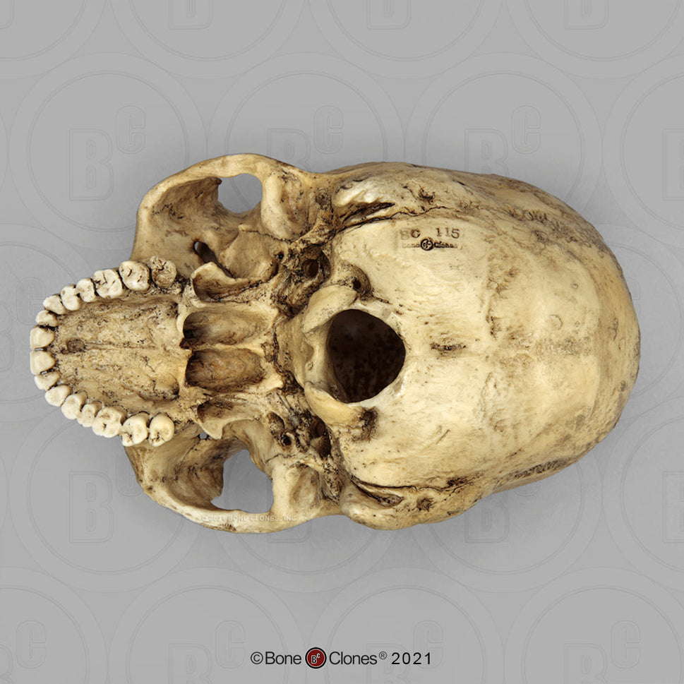 Bone Clones Forensic Trauma Skulls