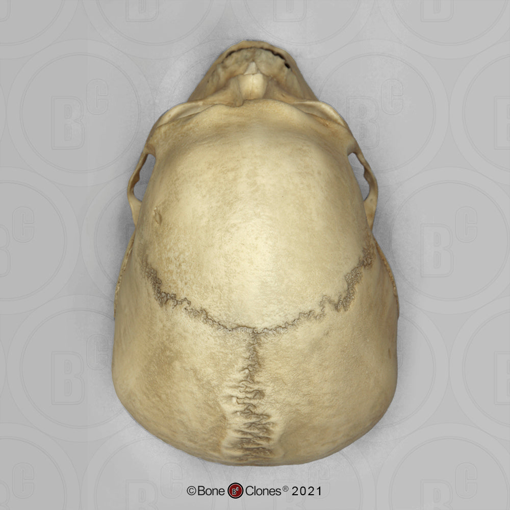 Bone Clones Forensic Trauma Skulls