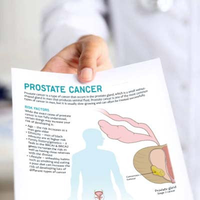Prostate Cancer Patient Education Handout (Printable PDF)