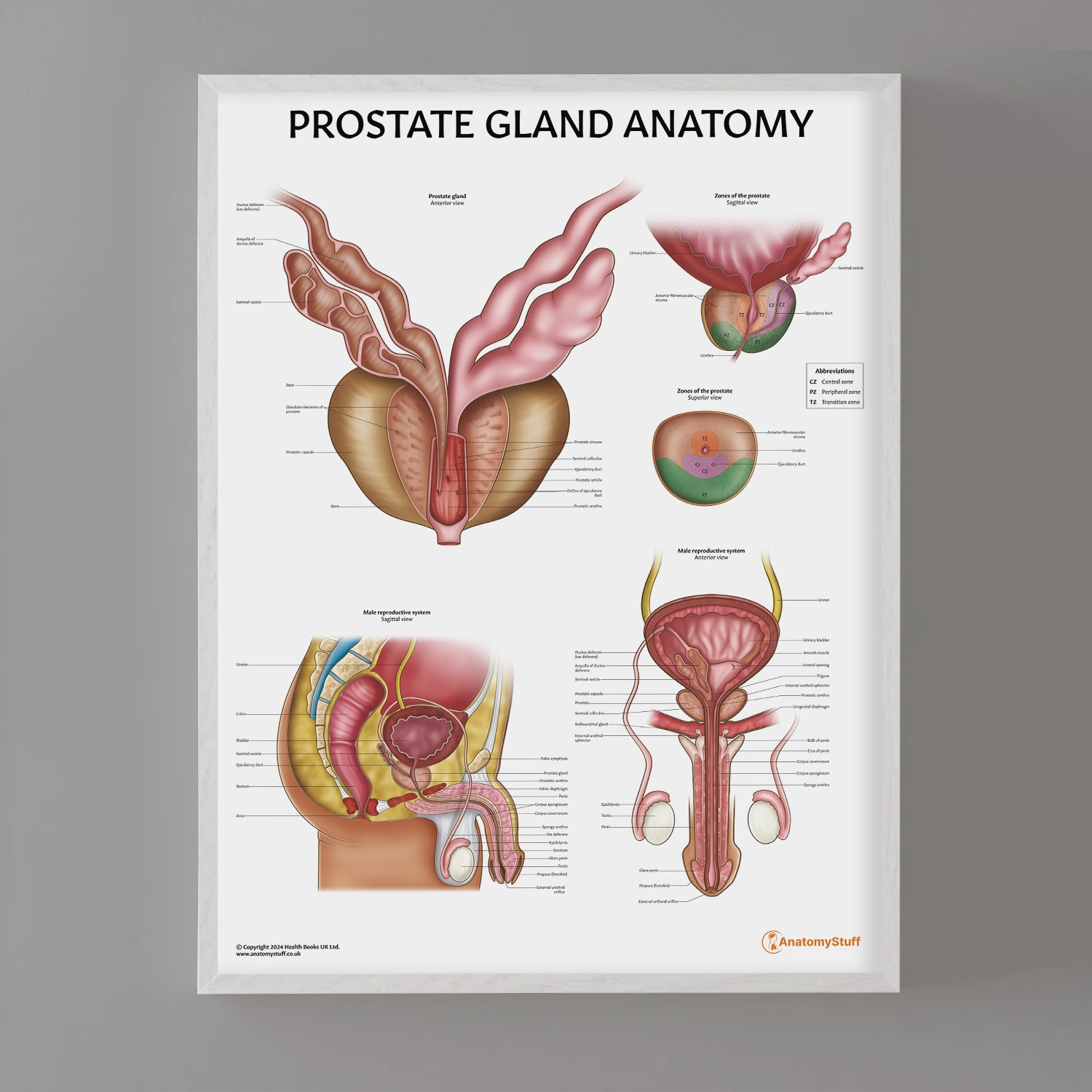 Prostate Anatomy Chart / Poster - Part of Collection