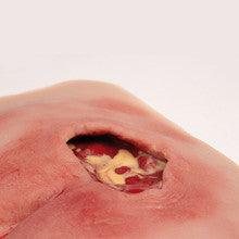 Wound Moulage
