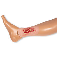 Wound Moulage