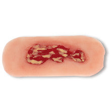 Wound Moulage