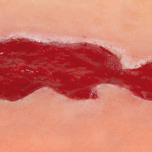 Wound Moulage