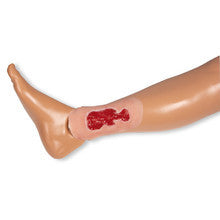 Wound Moulage