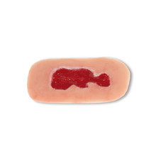 Wound Moulage