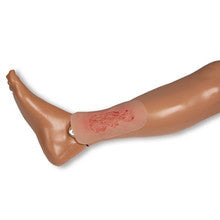 Wound Moulage