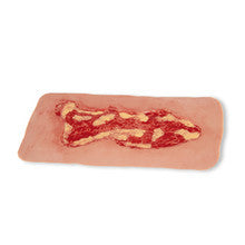 Wound Moulage