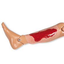 Wound Moulage