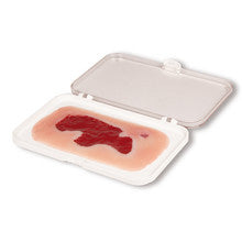 Wound Moulage