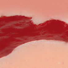 Wound Moulage