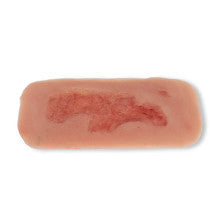 Wound Moulage