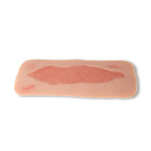 Wound Moulage
