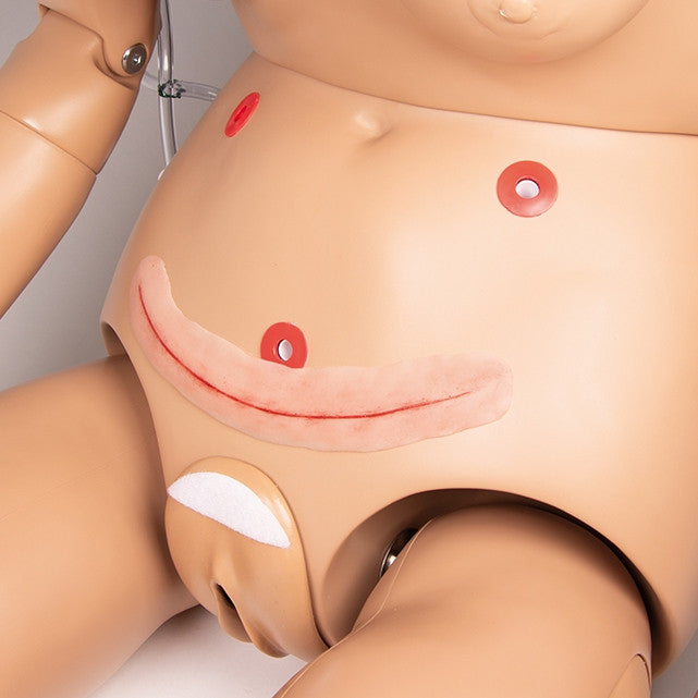 Surgical Wound for Suturing