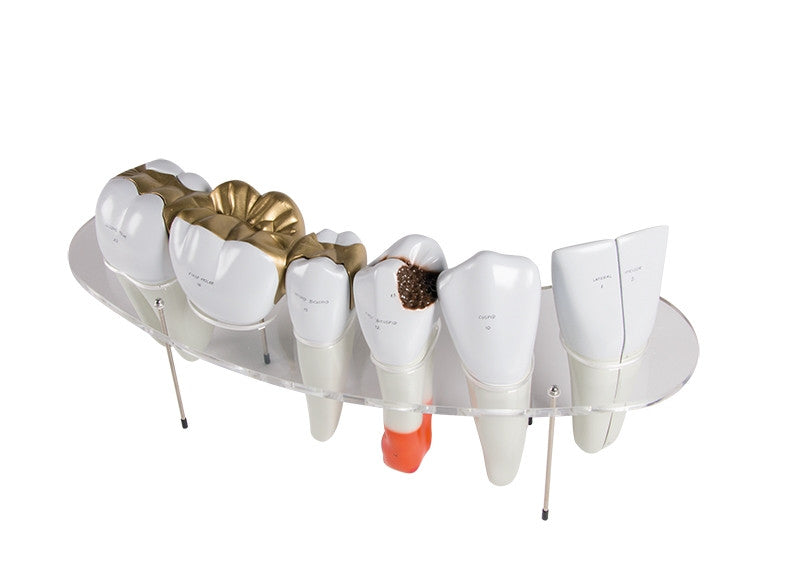 Dental Morphology Series (10 times life size, 7 Part)