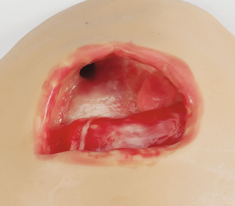 Negative Pressure Wound Therapy Training Models (Set of 3)