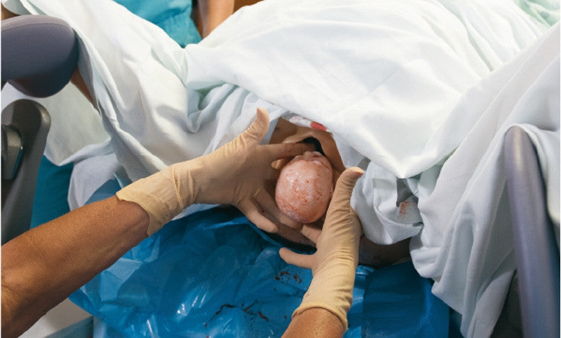 Complete Lucy Maternal and Neonatal Birthing Simulator