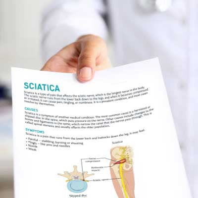 Sciatica Patient Education Handout (Printable PDF)