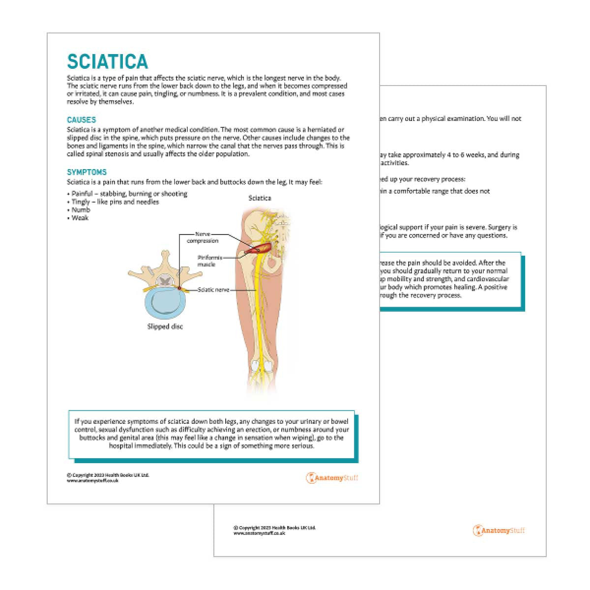 Sciatica Patient Education Handout (Printable PDF)