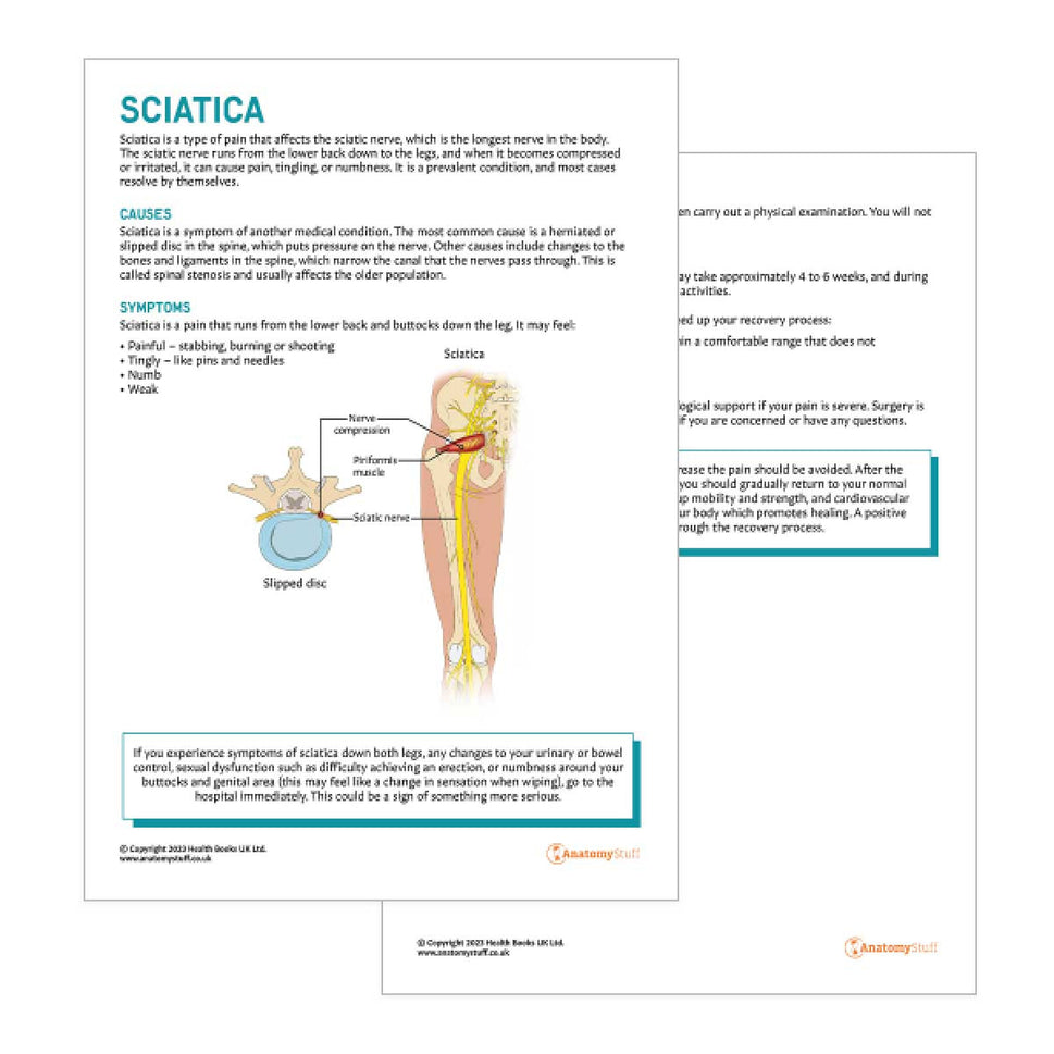Sciatica Patient Education Handout (Printable PDF)