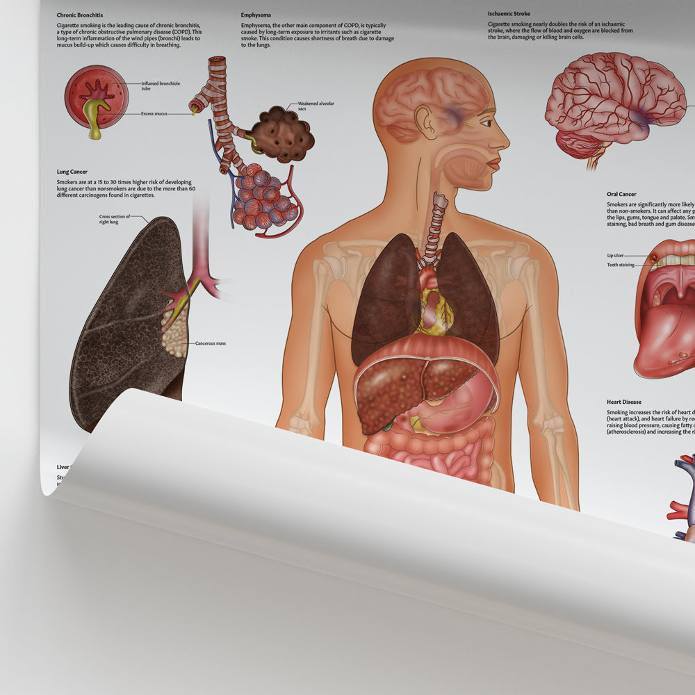 Smoking and The Body Chart / Poster