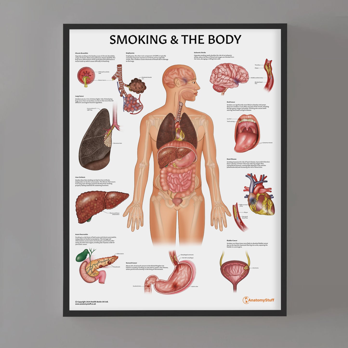 Smoking and The Body Chart / Poster