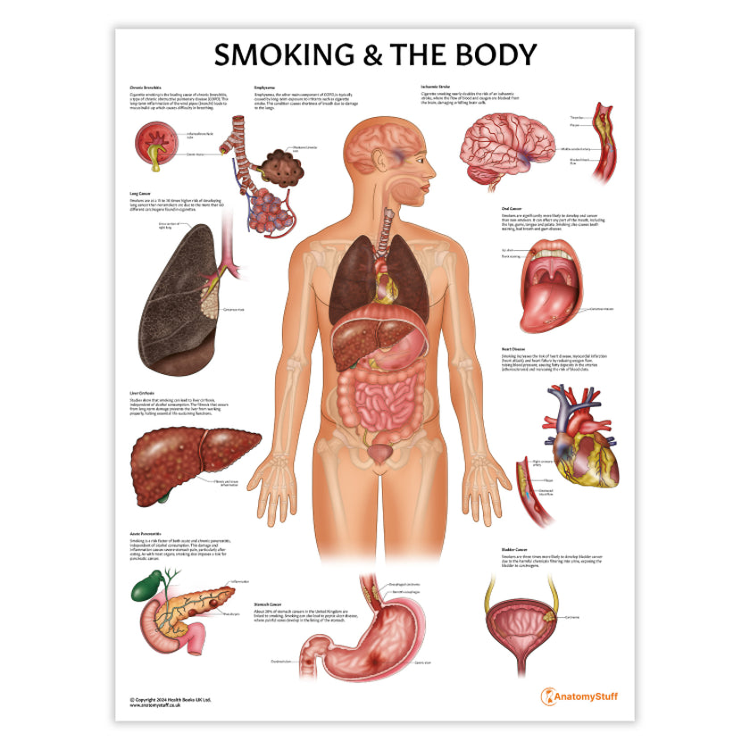 Smoking and The Body Chart / Poster