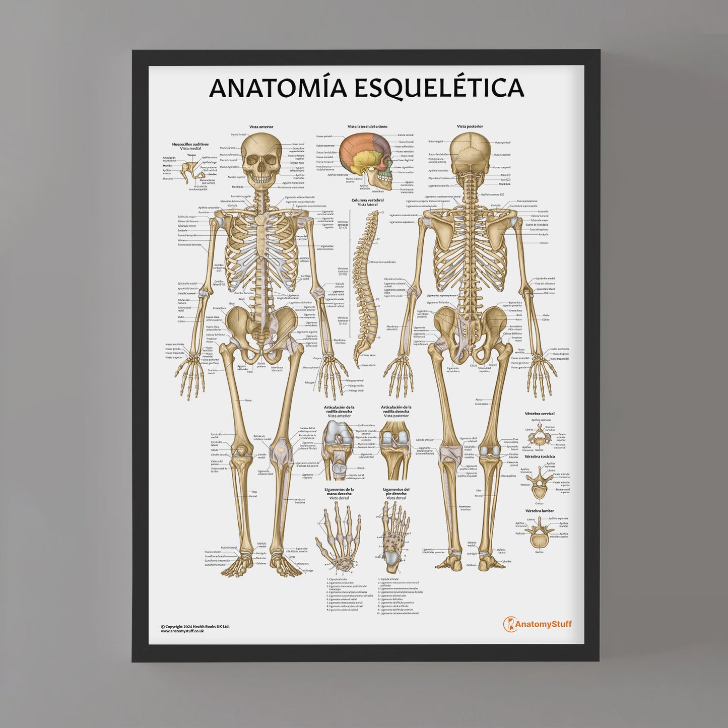 Anatomia Esquelitica Chart / Poster - Spanish