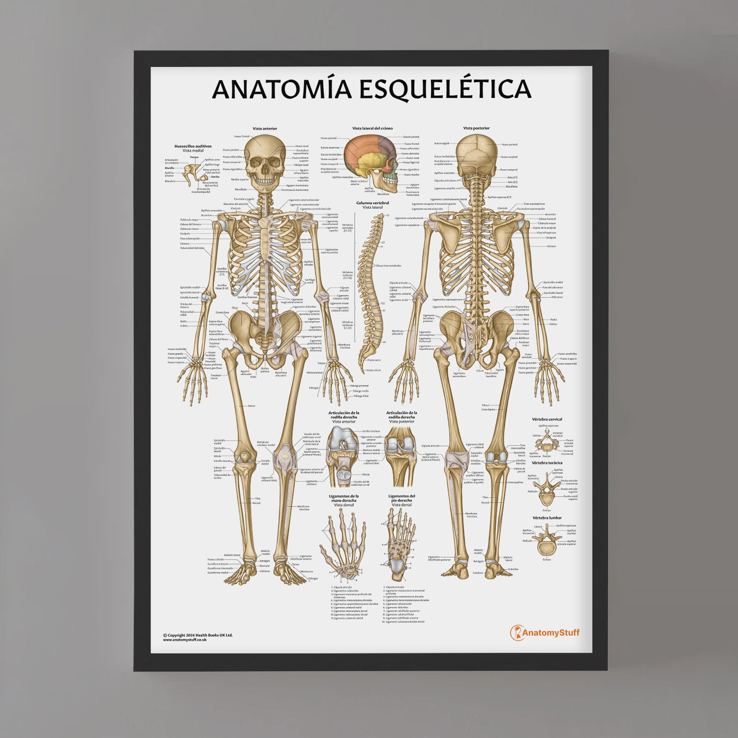 Anatomia Esquelitica Chart / Poster - Spanish
