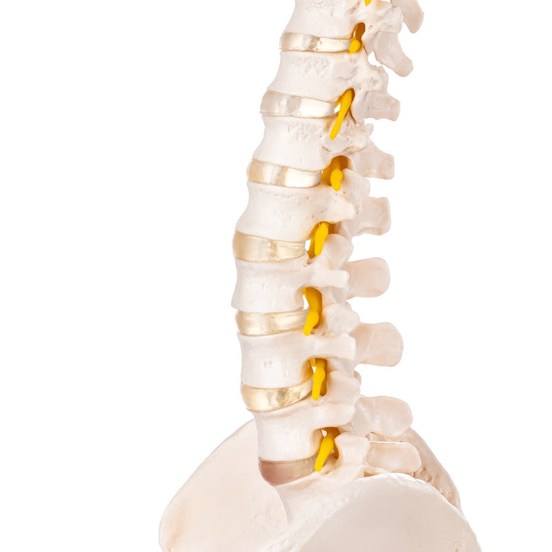 Spine model with herniated disc