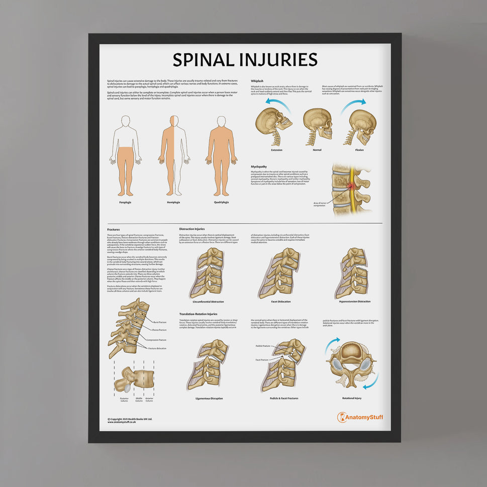 Spinal Injuries Chart / Poster