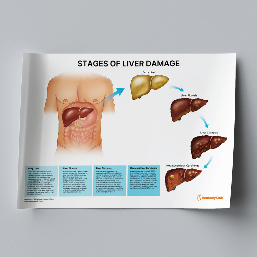 Stages of Liver Damage (Printable PDF)