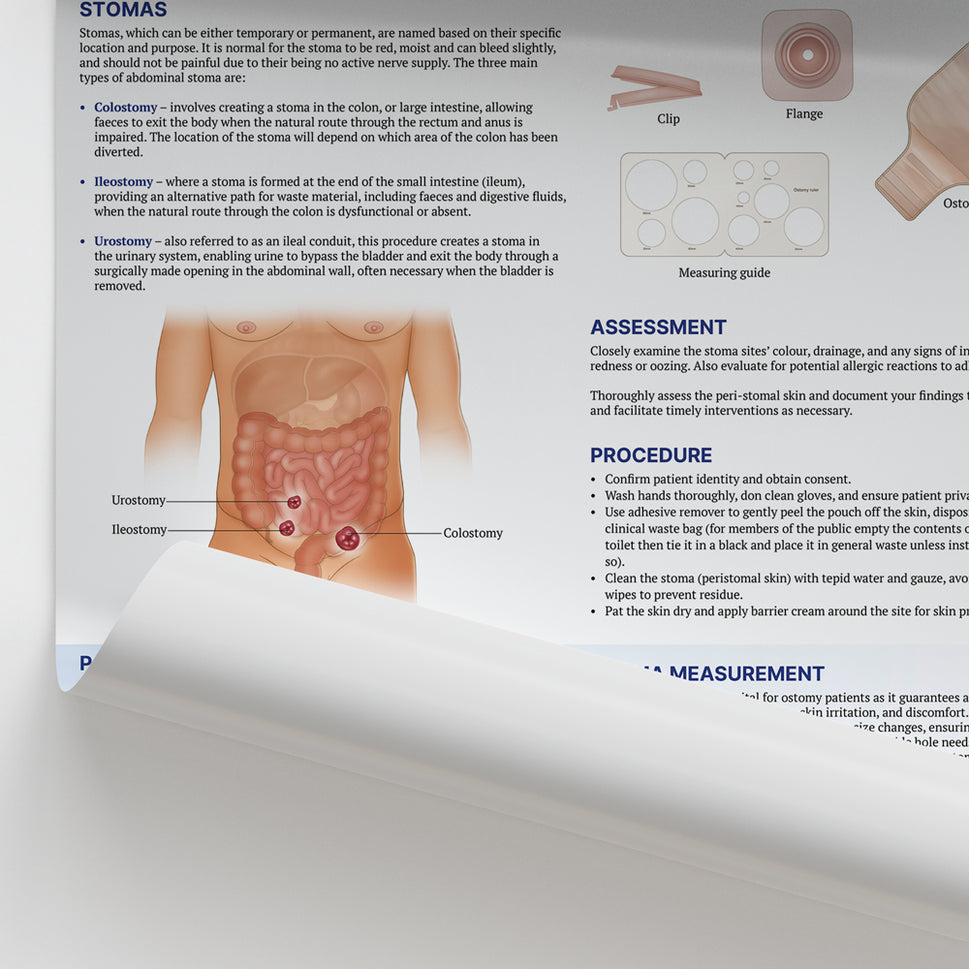 Stoma Care Chart / Poster