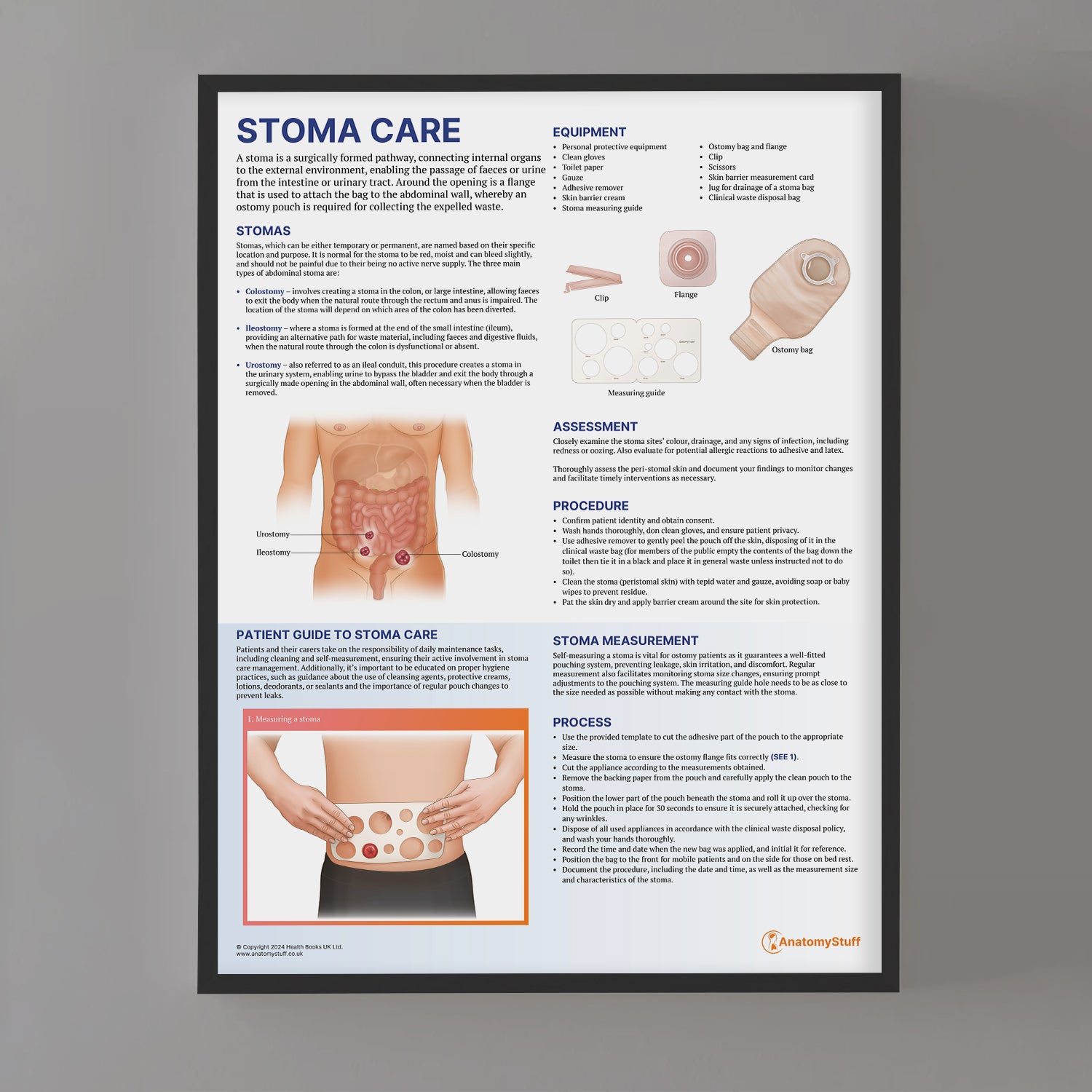 Stoma Care Chart / Poster - Part of Collection