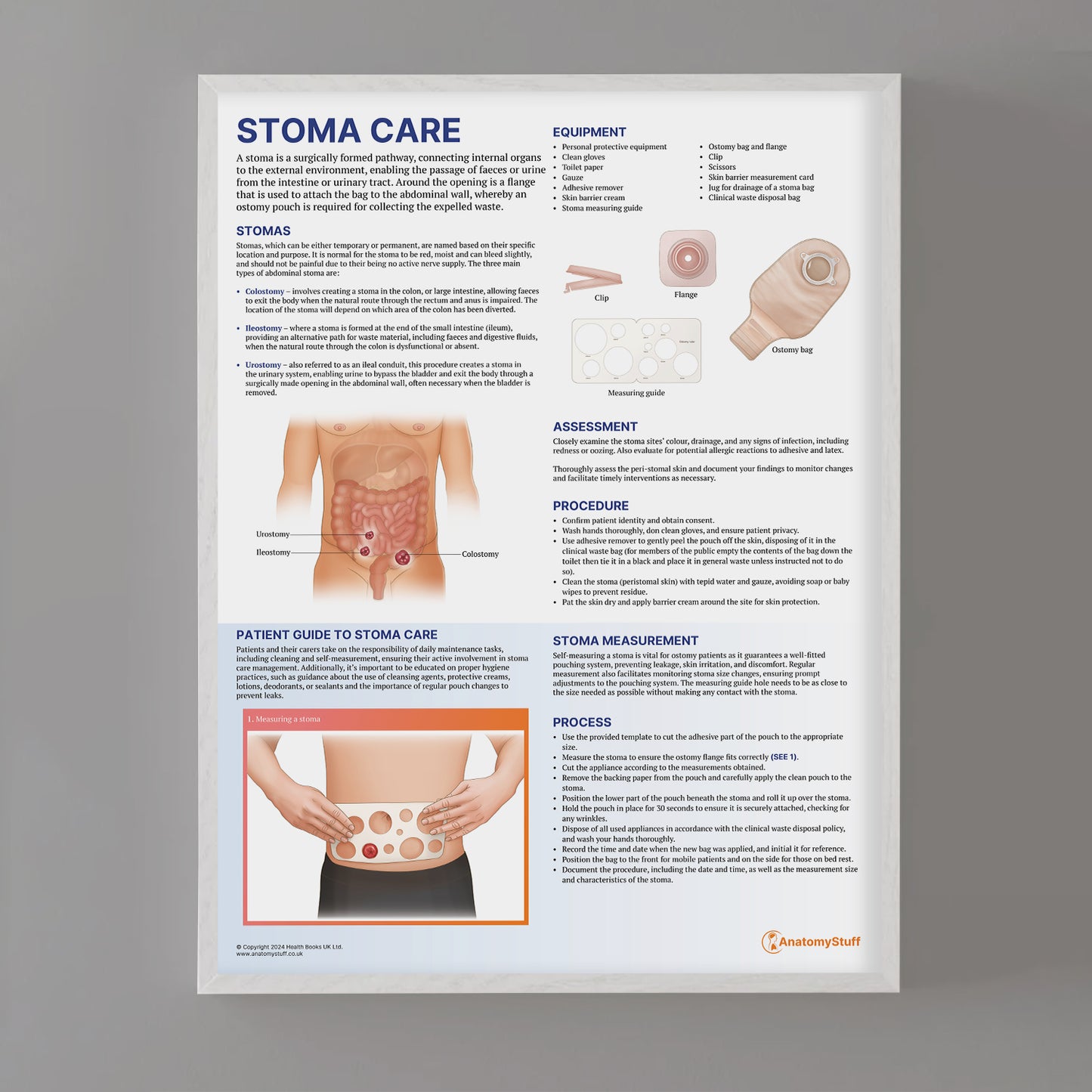 Stoma Care Chart / Poster - Part of Collection