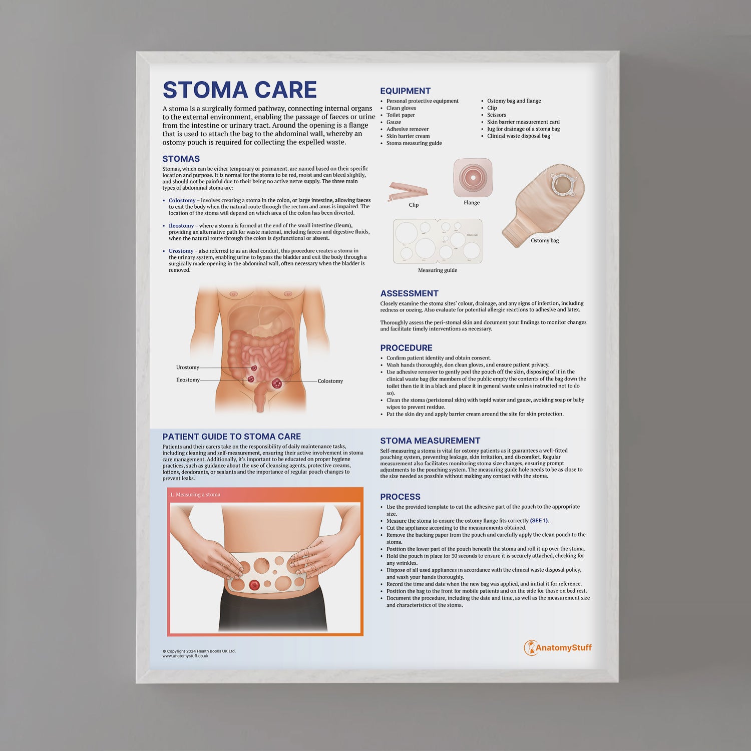 Stoma Care Chart / Poster - Part of Collection