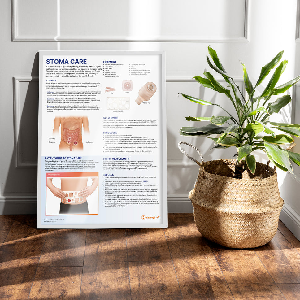 Stoma Care Chart / Poster