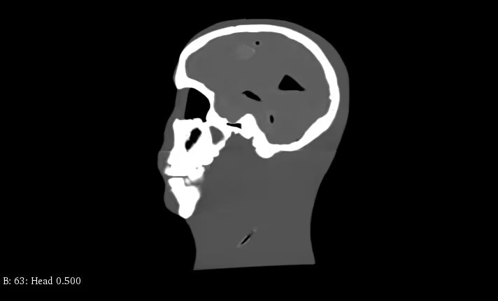 Adult Head Phantom (Standard) for X-Ray CT, US, MRI